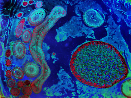 Certain infectious and parasitic diseases 